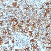 Formalin-fixed, paraffin-embedded Human Pancreas stained with Spectrin beta III Monoclonal Antibody (SPTBN2/1583).