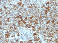 Formalin-fixed, paraffin-embedded Human Pancreas stained with Spectrin beta III Monoclonal Antibody (SPTBN2/1583).