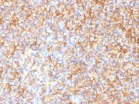 Formalin-fixed, paraffin-embedded Rat Pancreas stained with Spectrin beta III Monoclonal Antibody (SPTBN2/1584).