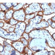 Formalin-fixed, paraffin-embedded Human Placenta stained with CD71 Monoclonal Antibody (TFRC/1818).
