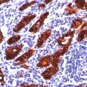 Formalin-fixed, paraffin-embedded human Thyroid stained with Thyroglobulin Monoclonal Antibody (2H11).