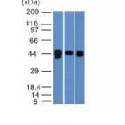 Western Blot of HepG2, PC3 and HeLa Cell Lysates with TIA1 Monoclonal Antibody (TIA1/1313).