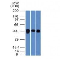 Western Blot of HepG2, PC3 and HeLa Cell Lysates with TIA1 Monoclonal Antibody (TIA1/1313).