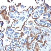 Formalin-fixed, paraffin-embedded human Placenta stained with TIMP2 Monoclonal Antibody (3A4).
