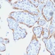 Formalin-fixed, paraffin-embedded human Placenta stained with TIMP2 Monoclonal Antibody (SPM356).