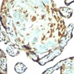 Formalin-fixed, paraffin-embedded human Placenta stained with TIMP3 Rabbit Polyclonal Antibody.