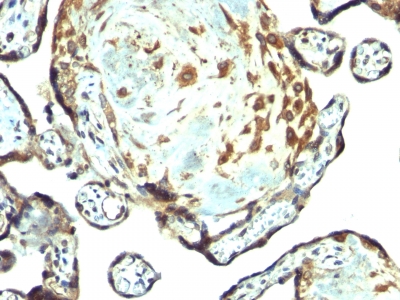 Formalin-fixed, paraffin-embedded human Placenta stained with TIMP3 Rabbit Polyclonal Antibody.