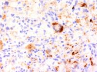 Formalin-fixed, paraffin-embedded Rat Pancreas stained with TNF alpha Monoclonal Antibody (TNF76)