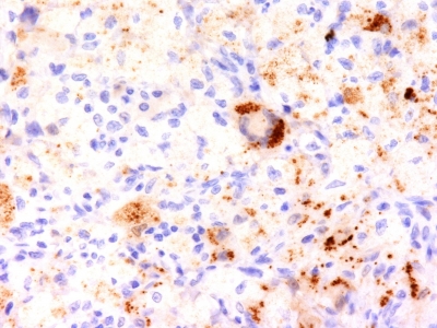 Formalin-fixed, paraffin-embedded Rat Pancreas stained with TNF alpha Monoclonal Antibody (TNF76)