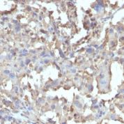 Formalin-fixed, paraffin-embedded Human Pancreas stained with TNF-alpha Recombinant Rabbit Monoclonal Antibody (TNF/15R).