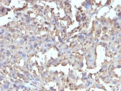 Formalin-fixed, paraffin-embedded Human Pancreas stained with TNF-alpha Recombinant Rabbit Monoclonal Antibody (TNF/15R).