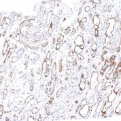 Formalin-fixed, paraffin-embedded human Kidney Transplant stained with Complement 4d Monoclonal Antibody (C4D24).