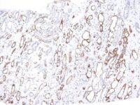 Formalin-fixed, paraffin-embedded human Kidney Transplant stained with Complement 4d Monoclonal Antibody (C4D24).