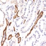 Formalin-fixed, paraffin-embedded human Kidney Transplant stained with Complement 4d Monoclonal Antibody (SPM545).