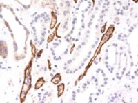 Formalin-fixed, paraffin-embedded human Kidney Transplant stained with Complement 4d Monoclonal Antibody (SPM545).