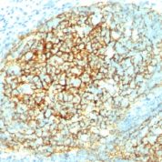 Formalin-fixed, paraffin-embedded human Tonsil stained with CD16 Monoclonal Antibody (1.4C3).