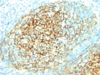 Formalin-fixed, paraffin-embedded human Tonsil stained with CD16 Monoclonal Antibody (1.4C3).