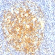 Formalin-fixed, paraffin-embedded human Tonsil stained with CD16 Monoclonal Antibody (VCAM1/843).
