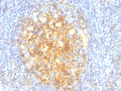 Formalin-fixed, paraffin-embedded human Tonsil stained with CD16 Monoclonal Antibody (VCAM1/843).