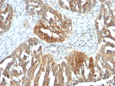 Formalin-fixed, paraffin-embedded human Tonsil stained with VEGF Monoclonal Antibody (VEGF/163).