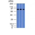 Formalin-fixed, paraffin-embedded human Rectum stained with Villin Monoclonal Antibody (VIL1/1314).