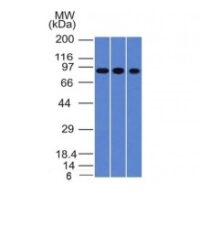 Formalin-fixed, paraffin-embedded human Rectum stained with Villin Monoclonal Antibody (VIL1/1314).