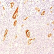 Formalin-fixed, paraffin-embedded human Tonsil stained with vWF Monoclonal Antibody (3E2D1)