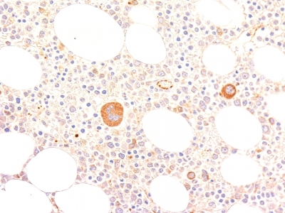 Formalin-fixed, paraffin-embedded human Tonsil stained with vWF Monoclonal Antibody (VWF635)