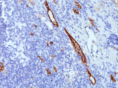 Formalin-fixed, paraffin-embedded human Tonsil stained with vWF Monoclonal Antibody (SPM577