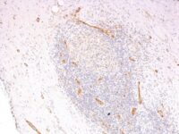 Formalin-fixed, paraffin-embedded human Tonsil stained with vWF Monoclonal Antibody (3E2D1 + VWF635)