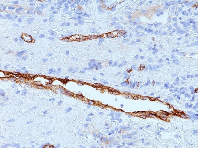 Formalin-fixed, paraffin-embedded human Tonsil stained with vWF Monoclonal Antibody (IIIE2.34)