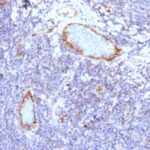 Western Blot Analysis A) Recombinant Protein (B) human lung lysate Using Monoclonal Antibody MAb (VWF/1465)