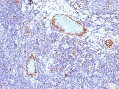 Western Blot Analysis A) Recombinant Protein (B) human lung lysate Using Monoclonal Antibody MAb (VWF/1465)