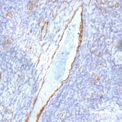 Formalin-fixed, paraffin-embedded human Tonsil stained with vWF Monoclonal Antibody (F8/86)