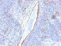 Formalin-fixed, paraffin-embedded human Tonsil stained with vWF Monoclonal Antibody (F8/86)