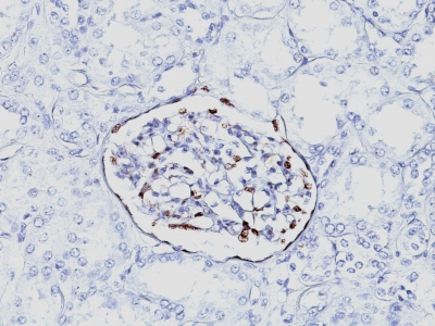 Formalin-fixed, paraffin-embedded human Fetal Kidney stained with WT1 Monoclonal Antibody (6F-H2).