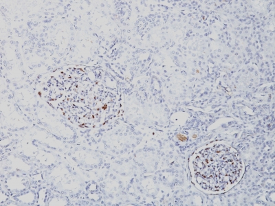Formalin-fixed, paraffin-embedded human Fetal Kidney stained with WT1 Monoclonal Antibody (SPM361).
