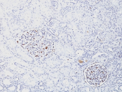 Formalin-fixed, paraffin-embedded Human Kidney stained with Wilm?s Tumor Recombinant Rabbit Monoclonal Antibody (WT1/1434R).