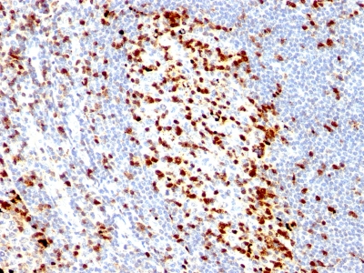 Formalin-fixed, paraffin embedded human tonsil sections stained with 100 ul anti-Histone H1 (clone HH1/957) at 1:100. HIER epitope retrieval prior to staining was performed in 10mM Citrate, pH 6.0.