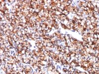 Western Blot Analysis of HCT116 Cell Lysate using CAIX Monoclonal Antibody (CA9/781).