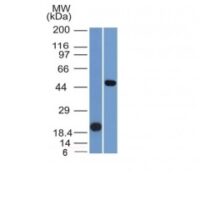 Western Blot Analysis (A) Recombinant Protein (B) Raji Cell Lysate Using PAX8 Monoclonal Antibody (PAX8/1491).