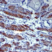 Formalin-fixed, paraffin-embedded human Uterus stained with Caldesmon Monoclonal Antibody (h-CALD).