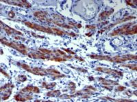 Formalin-fixed, paraffin-embedded human Uterus stained with Caldesmon Monoclonal Antibody (h-CALD).