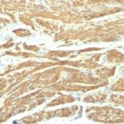 Formalin-fixed, paraffin-embedded human Uterus stained with Caldesmon Monoclonal Antibody (SPM168).