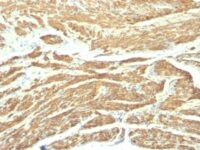 Formalin-fixed, paraffin-embedded human Uterus stained with Caldesmon Monoclonal Antibody (SPM168).