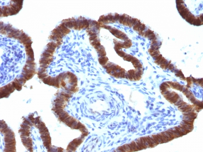 Formalin-fixed, paraffin-embedded human Endometrium stained with ASRGL1 Monoclonal Antibody (CRASH/1289).