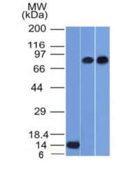 Western Blot of Recombinant, PC3 and HeLa Cell Lysates using p63 Monoclonal Antibody (TP63/1786).