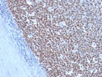 Formalin-fixed, paraffin-embedded human Testicular Carcinoma stained with Cyclin B1 Monoclonal Antibody (CCNB1/198)