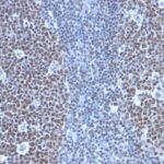 Formalin-fixed, paraffin-embedded human Tonsil stained with Cyclin B1 Monoclonal Antibody (SPM619)