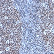 Formalin-fixed, paraffin-embedded human Tonsil stained with Cyclin B1 Monoclonal Antibody (SPM619)